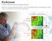 1 - 20000Hz LEIDENE van de frequentiecontrole 810nm Lichte Helm voor de Therapie van Parkinson Alzheimer